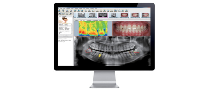 Dental Imaging – Cameras | X-rays | Scanners